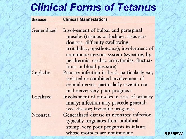 Clinical Forms of Tetanus REVIEW 