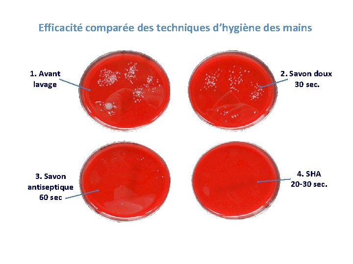 Efficacité comparée des techniques d’hygiène des mains 1. Avant lavage 3. Savon antiseptique 60