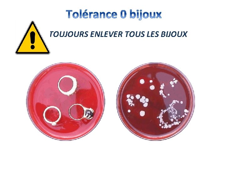 TOUJOURS ENLEVER TOUS LES BIJOUX 