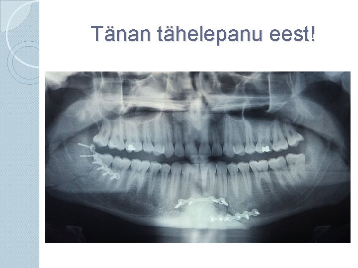 Tänan tähelepanu eest! 