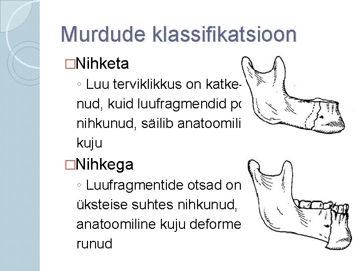 Murdude klassifikatsioon �Nihketa ◦ Luu terviklikkus on katkenud, kuid luufragmendid pole nihkunud, säilib anatoomiline