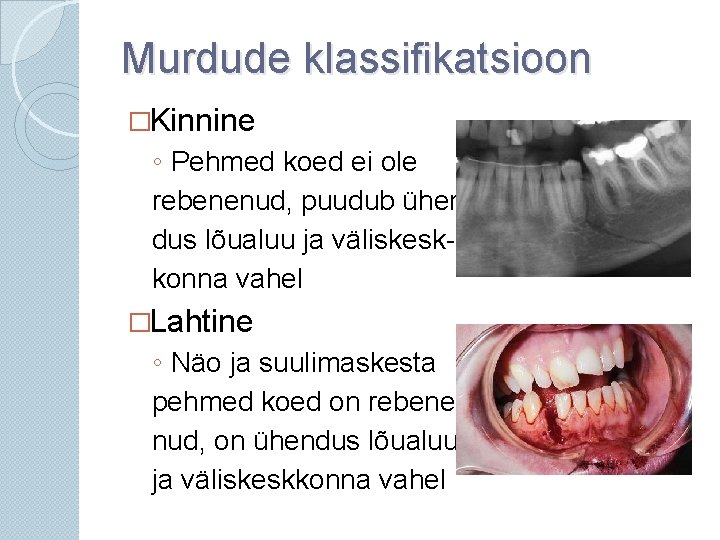 Murdude klassifikatsioon �Kinnine ◦ Pehmed koed ei ole rebenenud, puudub ühendus lõualuu ja väliskeskkonna