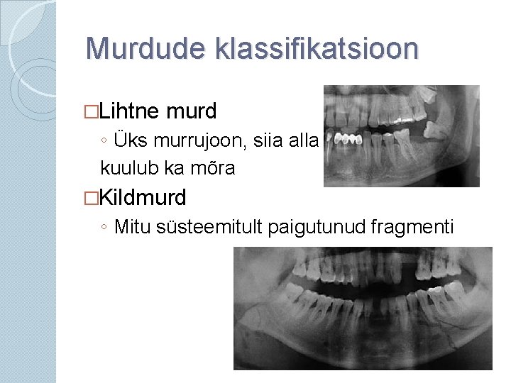 Murdude klassifikatsioon �Lihtne murd ◦ Üks murrujoon, siia alla kuulub ka mõra �Kildmurd ◦