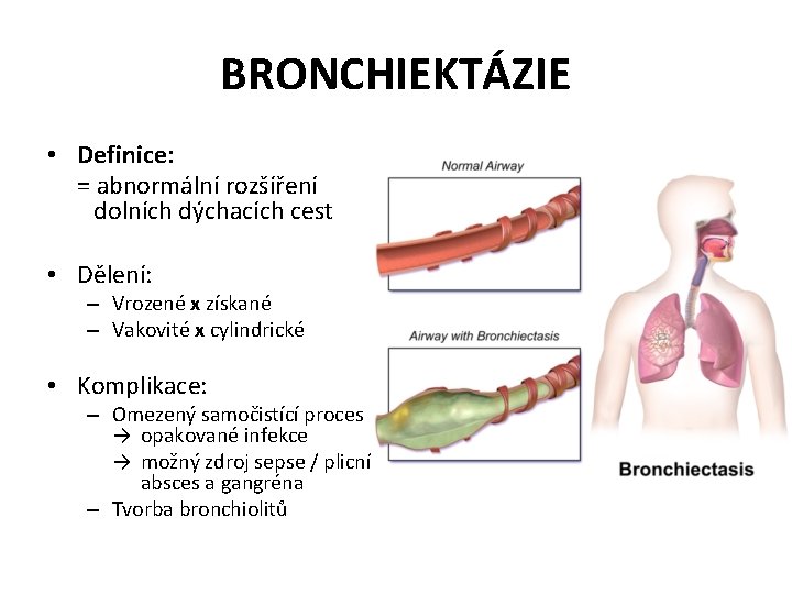 BRONCHIEKTÁZIE • Definice: = abnormální rozšíření dolních dýchacích cest • Dělení: – Vrozené x