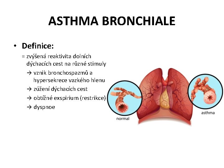 ASTHMA BRONCHIALE • Definice: = zvýšená reaktivita dolních dýchacích cest na různé stimuly →