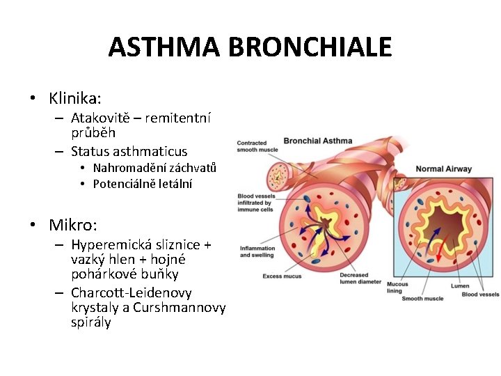 ASTHMA BRONCHIALE • Klinika: – Atakovitě – remitentní průběh – Status asthmaticus • Nahromadění