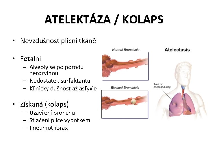 ATELEKTÁZA / KOLAPS • Nevzdušnost plicní tkáně • Fetální – Alveoly se po porodu
