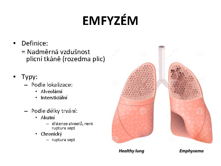 EMFYZÉM • Definice: = Nadměrná vzdušnost plicní tkáně (rozedma plic) • Typy: – Podle