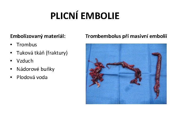 PLICNÍ EMBOLIE Embolizovaný materiál: • • • Trombus Tuková tkáň (fraktury) Vzduch Nádorové buňky