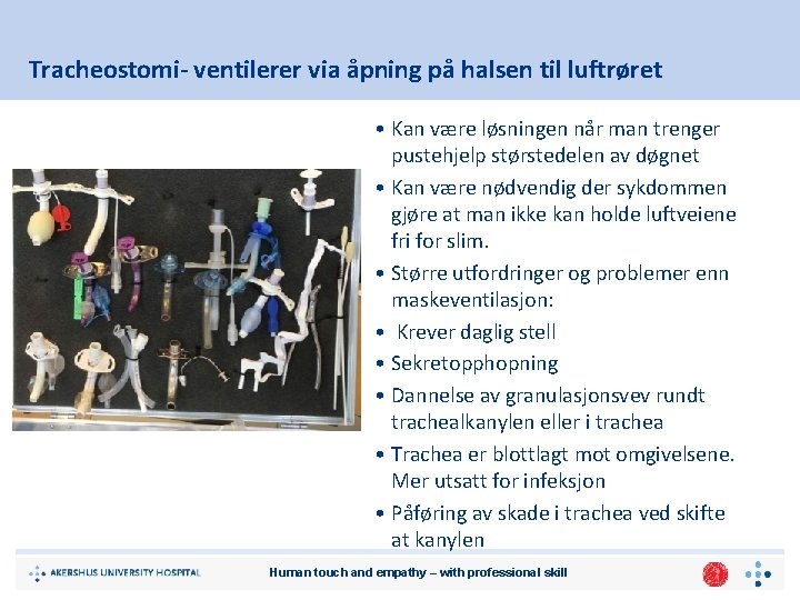 Tracheostomi- ventilerer via åpning på halsen til luftrøret • Kan være løsningen når man