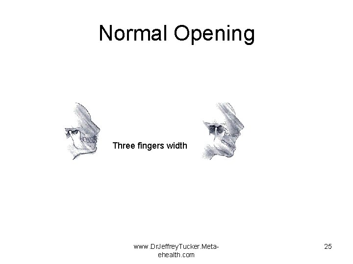 Normal Opening Three fingers width www. Dr. Jeffrey. Tucker. Metaehealth. com 25 