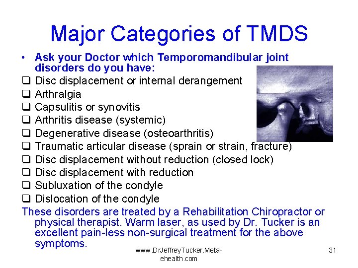 Major Categories of TMDS • Ask your Doctor which Temporomandibular joint disorders do you