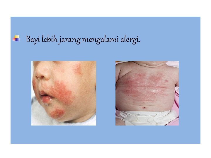 Bayi lebih jarang mengalami alergi. 