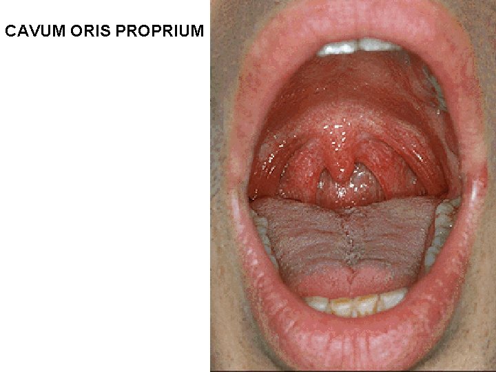 CAVUM ORIS PROPRIUM CAVUM ORIS PROPRIUM