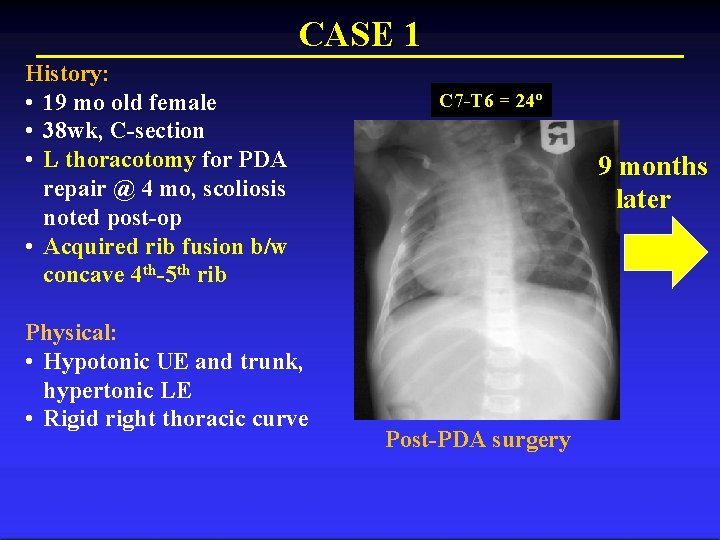 CASE 1 History: • 19 mo old female • 38 wk, C-section • L
