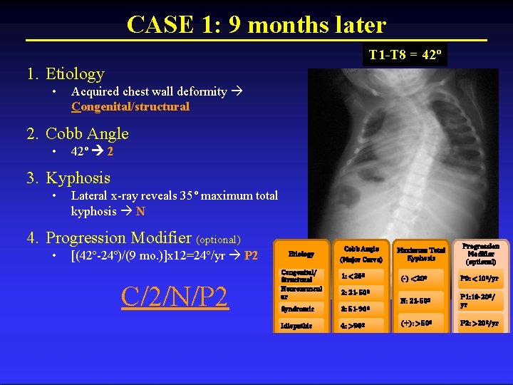 CASE 1: 9 months later T 1 -T 8 = 42º 1. Etiology •