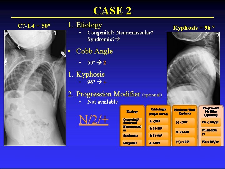 CASE 2 C 7 -L 4 = 50º 1. Etiology • Congenital? Neuromuscular? Syndromic?