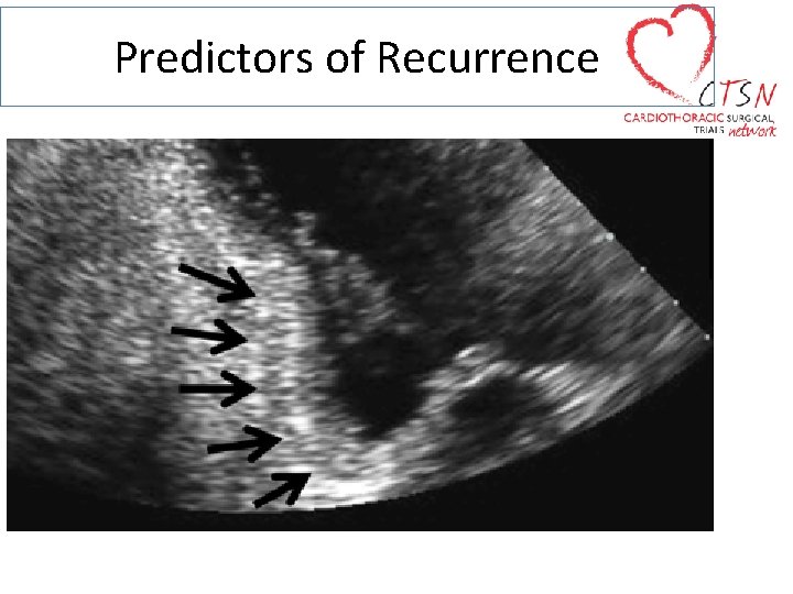 Predictors of Recurrence 