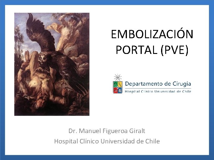 EMBOLIZACIÓN PORTAL (PVE) Dr. Manuel Figueroa Giralt Hospital Clínico Universidad de Chile 