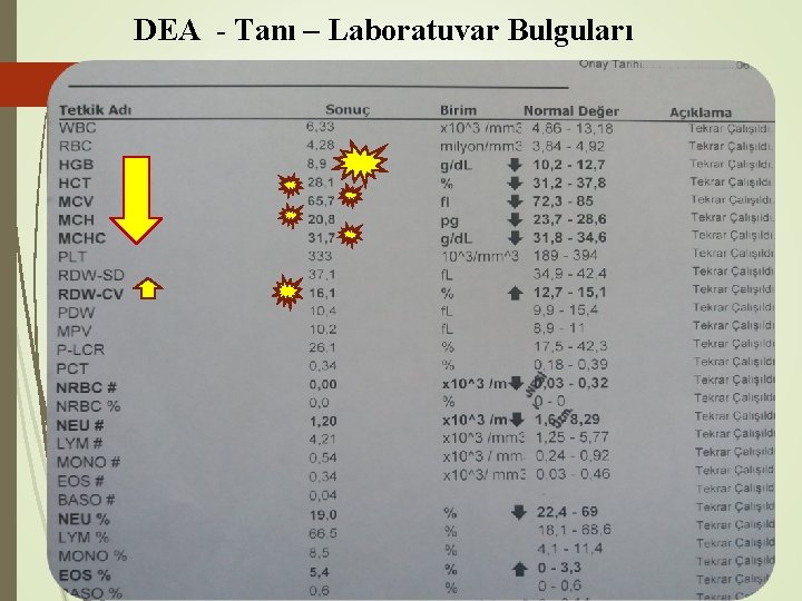  DEA - Tanı – Laboratuvar Bulguları 