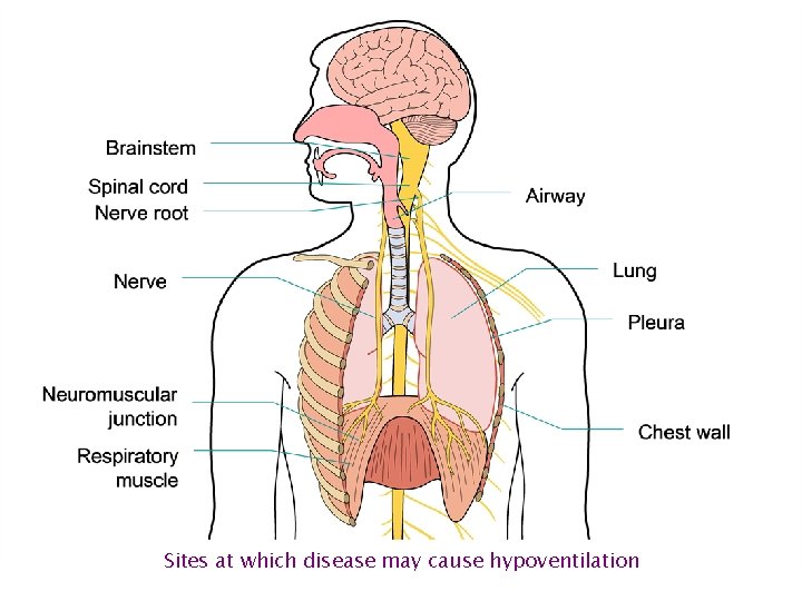 Sites at which disease may cause hypoventilation 