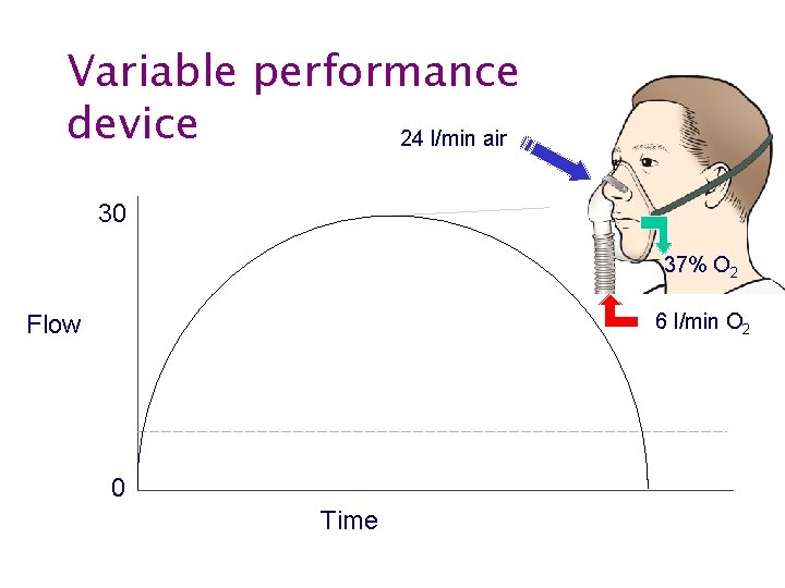 Variable performance device 24 l/min air 30 37% O 2 6 l/min O 2