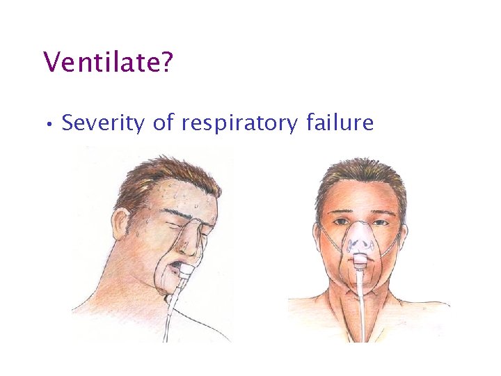 Ventilate? • Severity of respiratory failure 