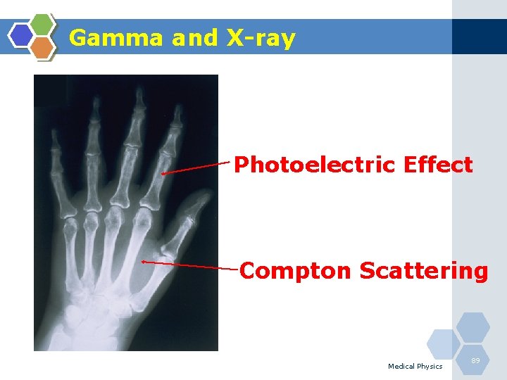 Gamma and X-ray Photoelectric Effect Compton Scattering Medical Physics 89 