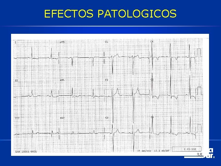 EFECTOS PATOLOGICOS 38 EFECTOS PATOLOGICOS 38