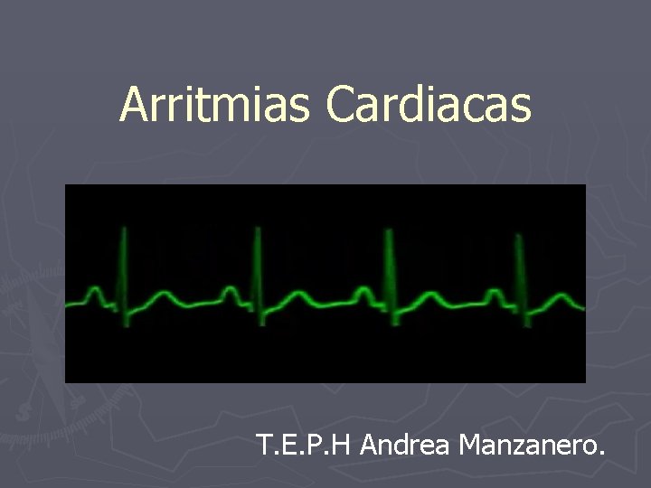 Arritmias Cardiacas T. E. P. H Andrea Manzanero. 