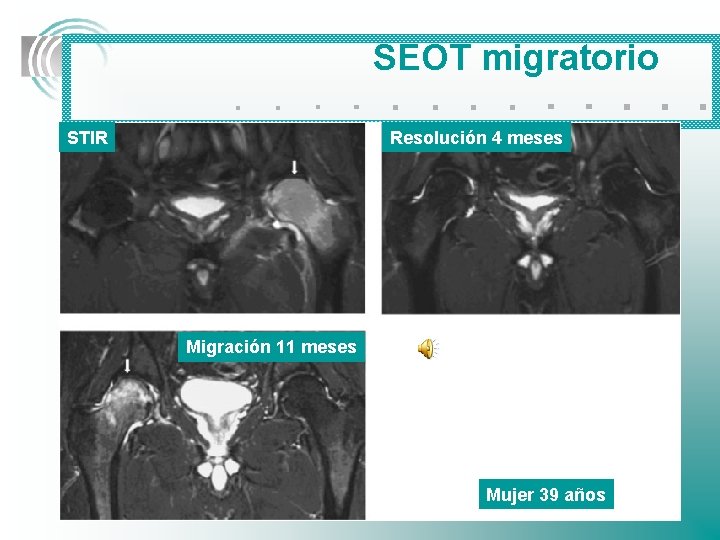 SEOT migratorio . . . STIR . . . Resolución 4 meses Migración 11