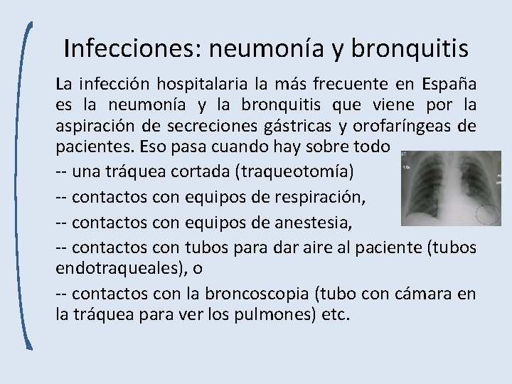 Infecciones: neumonía y bronquitis La infección hospitalaria la más frecuente en España es la