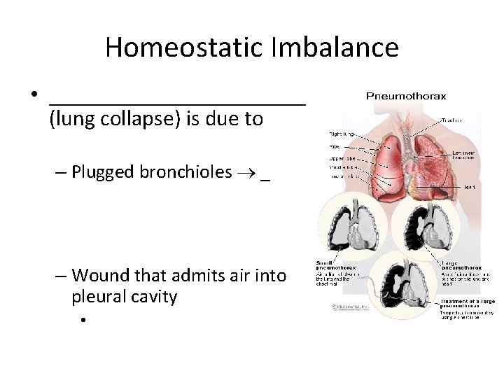 Homeostatic Imbalance • ____________ (lung collapse) is due to – Plugged bronchioles _ –