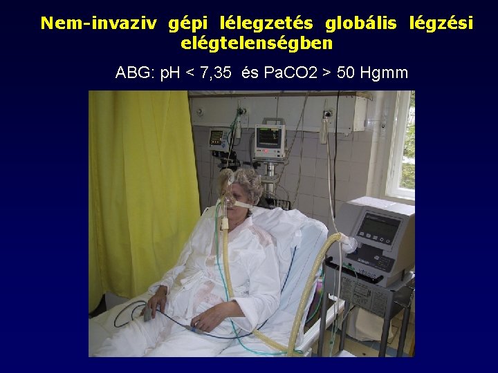 Nem-invaziv gépi lélegzetés globális légzési elégtelenségben ABG: p. H < 7, 35 és Pa.