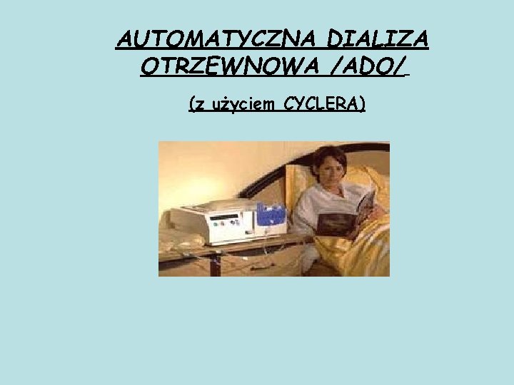 AUTOMATYCZNA DIALIZA OTRZEWNOWA /ADO/ (z użyciem CYCLERA) 