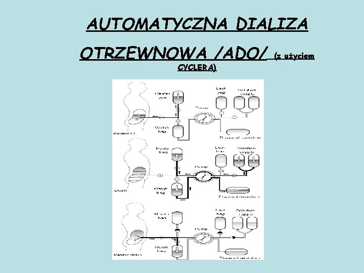 AUTOMATYCZNA DIALIZA OTRZEWNOWA /ADO/ CYCLERA) (z użyciem 