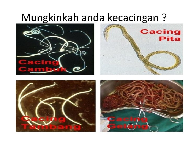 Mungkinkah anda kecacingan ? Mungkinkah anda kecacingan ?