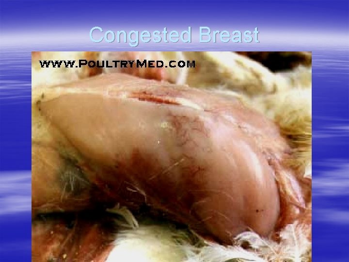 Congested Breast 