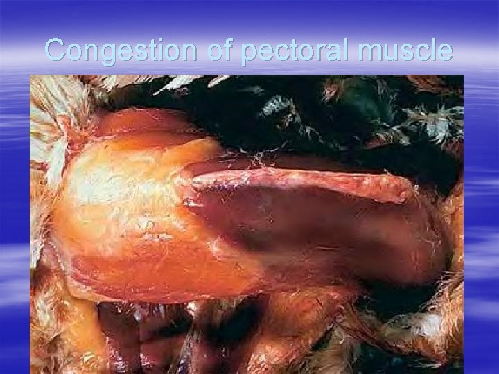 Congestion of pectoral muscle 