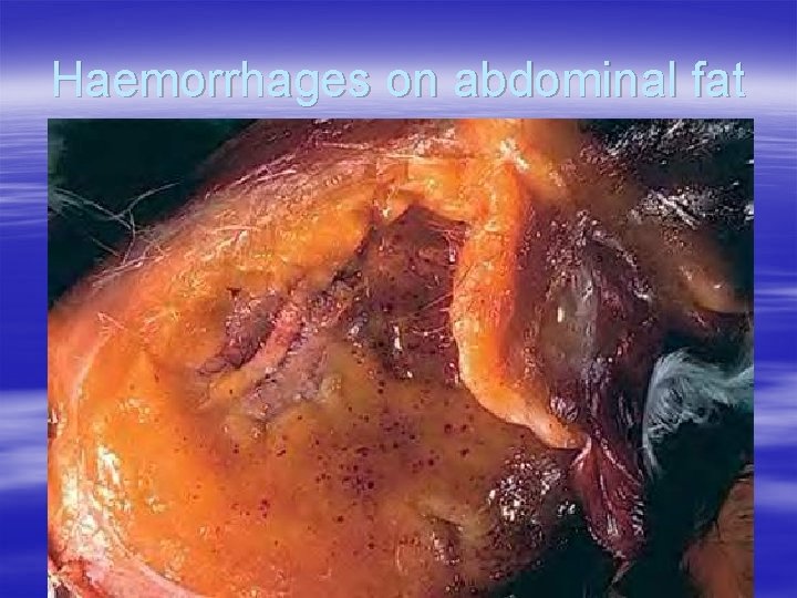 Haemorrhages on abdominal fat 