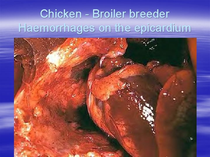 Chicken - Broiler breeder Haemorrhages on the epicardium 