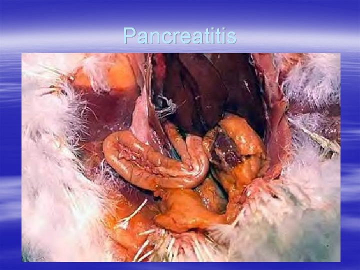 Pancreatitis 