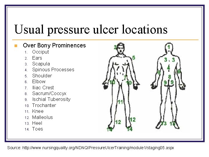 Usual pressure ulcer locations n Over Bony Prominences 1. 2. 3. 4. 5. 6.