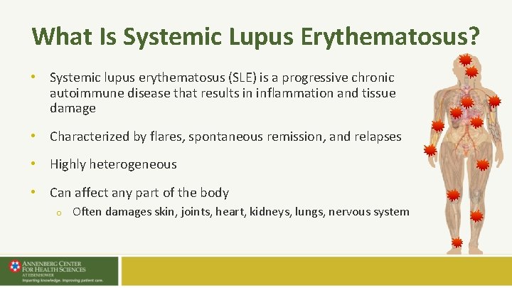 What Is Systemic Lupus Erythematosus? • Systemic lupus erythematosus (SLE) is a progressive chronic What Is Systemic Lupus Erythematosus? • Systemic lupus erythematosus (SLE) is a progressive chronic