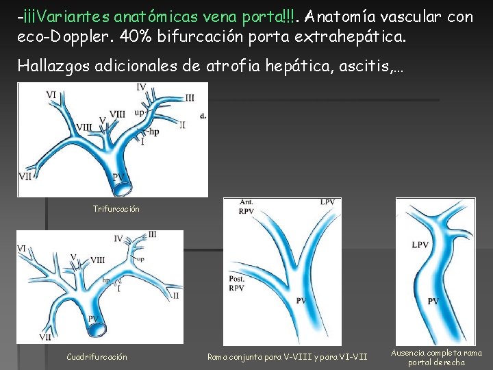 -¡¡¡Variantes anatómicas vena porta!!!. Anatomía vascular con eco-Doppler. 40% bifurcación porta extrahepática. Hallazgos adicionales