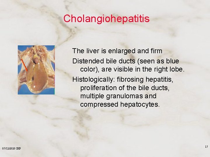 Cholangiohepatitis The liver is enlarged and firm Distended bile ducts (seen as blue color),