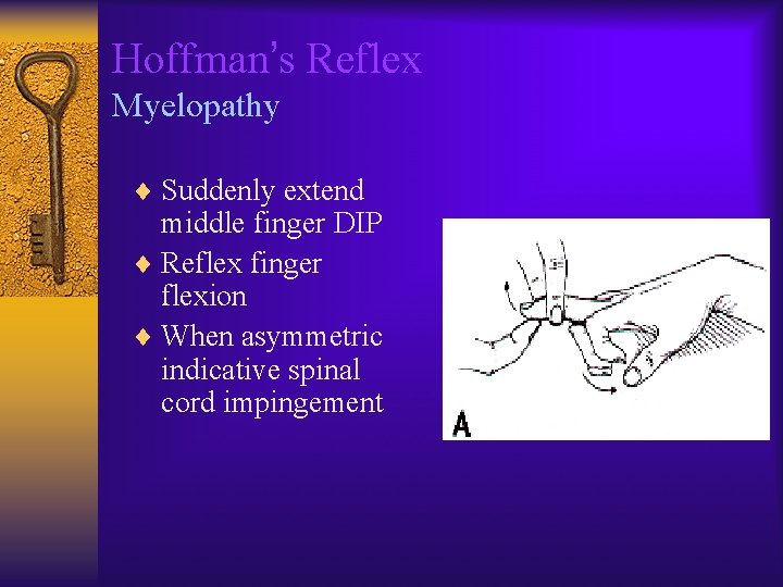 Hoffman’s Reflex Myelopathy ¨ Suddenly extend middle finger DIP ¨ Reflex finger flexion ¨