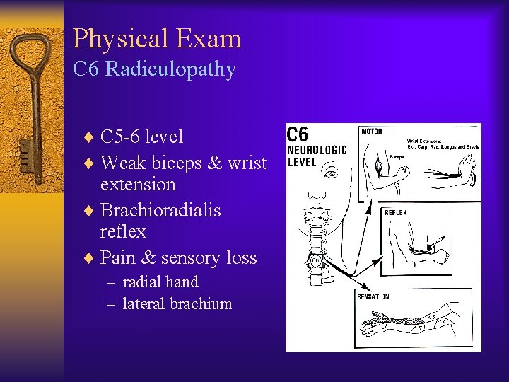 Physical Exam C 6 Radiculopathy ¨ C 5 -6 level ¨ Weak biceps &