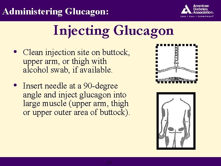 Administering Glucagon: Injecting Glucagon • Clean injection site on buttock, upper arm, or thigh