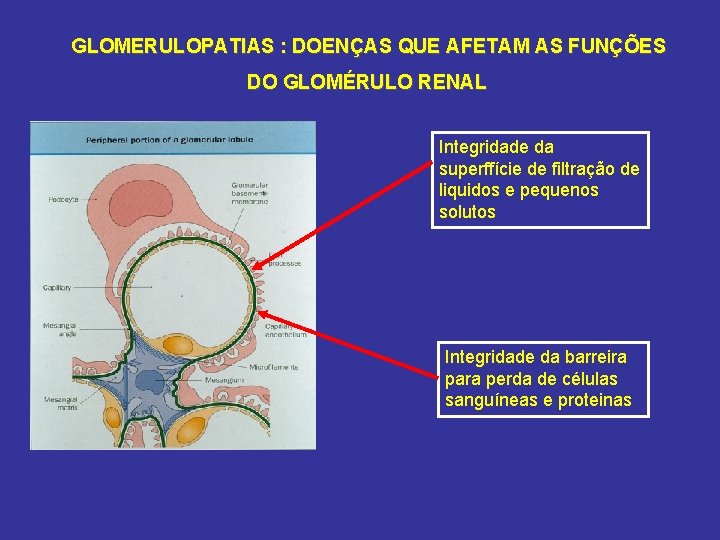 GLOMERULOPATIAS : DOENÇAS QUE AFETAM AS FUNÇÕES DO GLOMÉRULO RENAL Integridade da superffície de